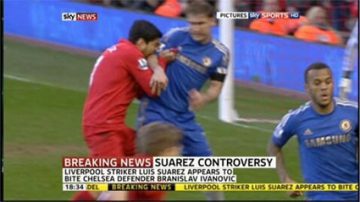 suarez_bite